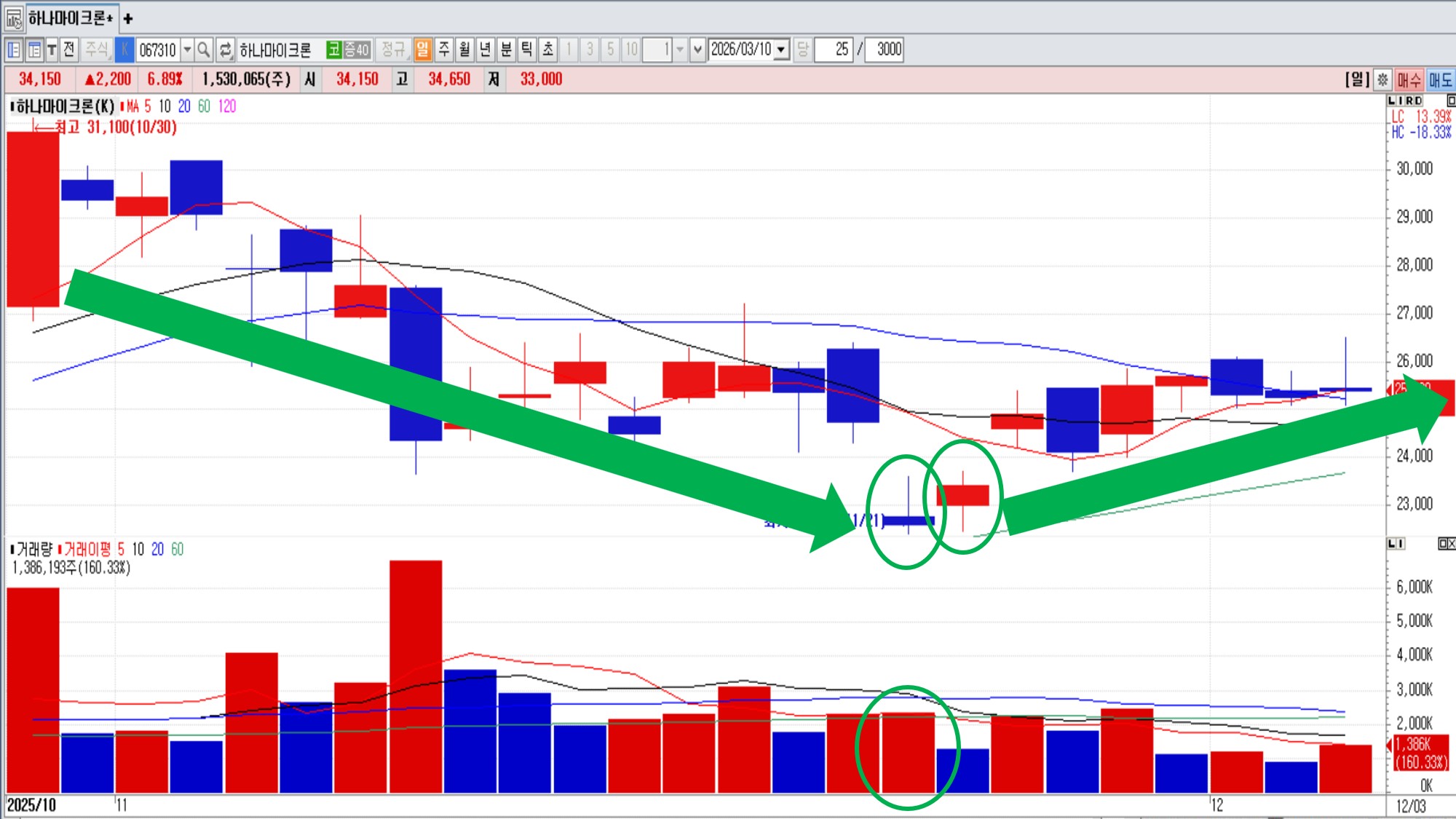 역망치형 캔들 해석 방법 - 5가지 핵심 사례 – 하나마이크론 일봉 (2025. 11. 21). 그래픽=정경춘기자